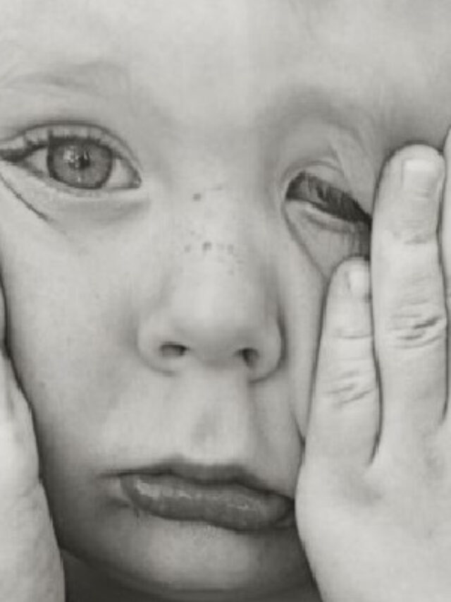 5 Things You Need to Know about Sensory Processing Disorder